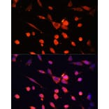Immunofluorescence - Anti-PI 3 Kinase p55 gamma Antibody (A92970) - Antibodies.com