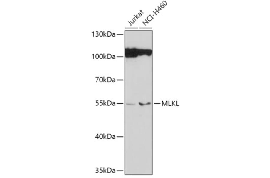 Western Blot - Anti-MLKL Antibody (A92971) - Antibodies.com