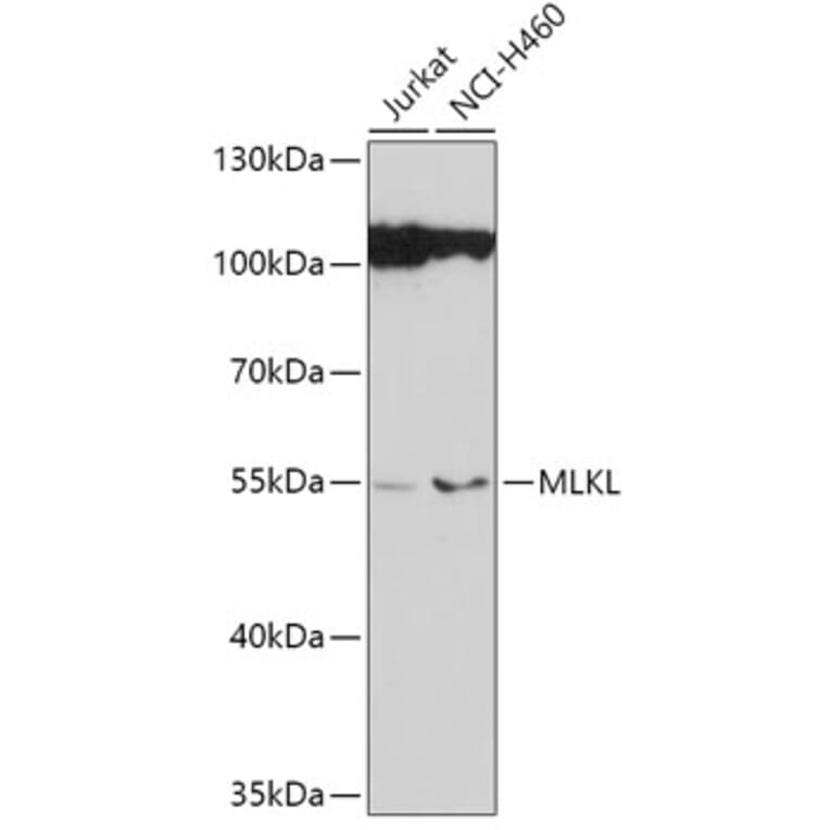 Western Blot - Anti-MLKL Antibody (A92971) - Antibodies.com