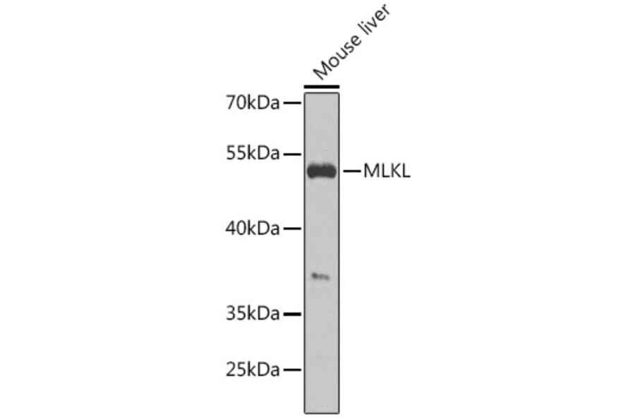 Western Blot - Anti-MLKL Antibody (A92971) - Antibodies.com
