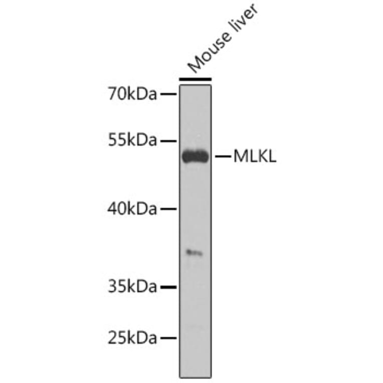 Western Blot - Anti-MLKL Antibody (A92971) - Antibodies.com