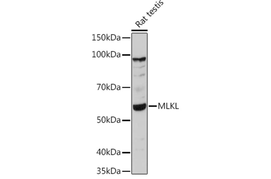Western Blot - Anti-MLKL Antibody (A92971) - Antibodies.com