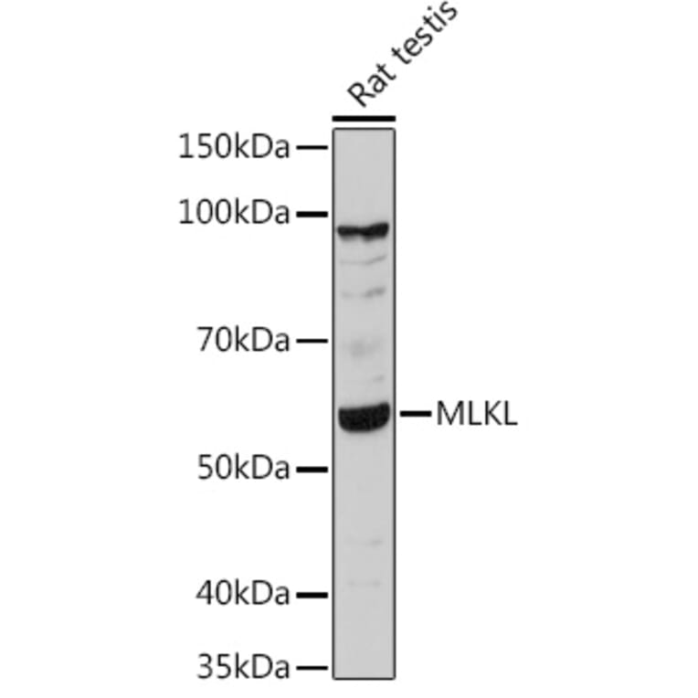 Western Blot - Anti-MLKL Antibody (A92971) - Antibodies.com