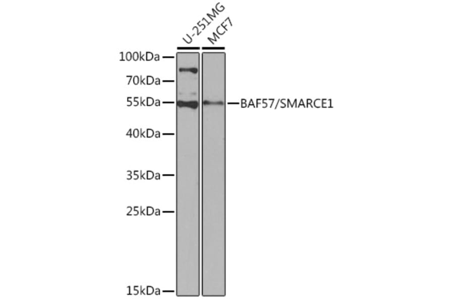 Western Blot - Anti-BAF57/SMARCE1 Antibody (A92974) - Antibodies.com