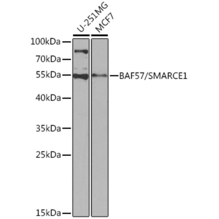 Western Blot - Anti-BAF57/SMARCE1 Antibody (A92974) - Antibodies.com