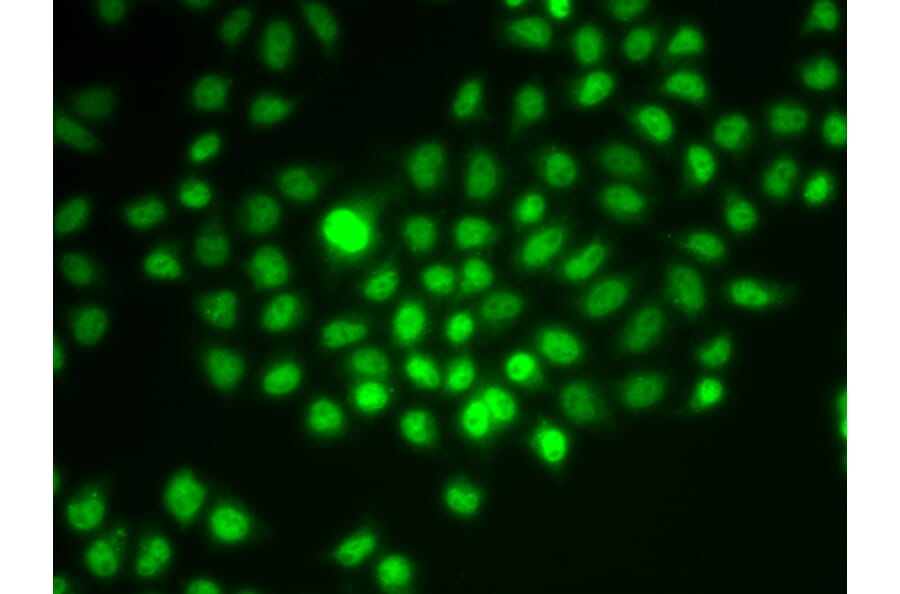 Immunofluorescence - Anti-BAF57/SMARCE1 Antibody (A92974) - Antibodies.com