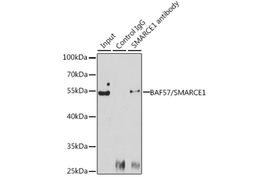 Western Blot - Anti-BAF57/SMARCE1 Antibody (A92974) - Antibodies.com
