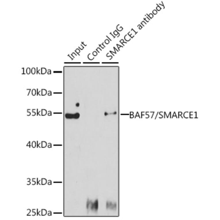 Western Blot - Anti-BAF57/SMARCE1 Antibody (A92974) - Antibodies.com