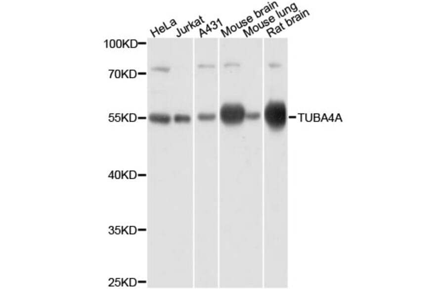 Western Blot - Anti-TUBA4A Antibody (AC031) - Antibodies.com