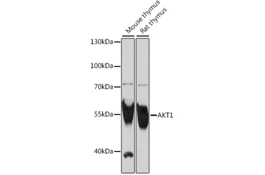 Western Blot - Anti-AKT1 Antibody (A16343) - Antibodies.com