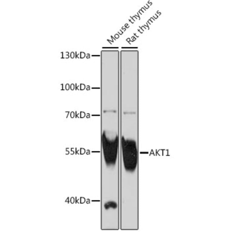 Western Blot - Anti-AKT1 Antibody (A16343) - Antibodies.com