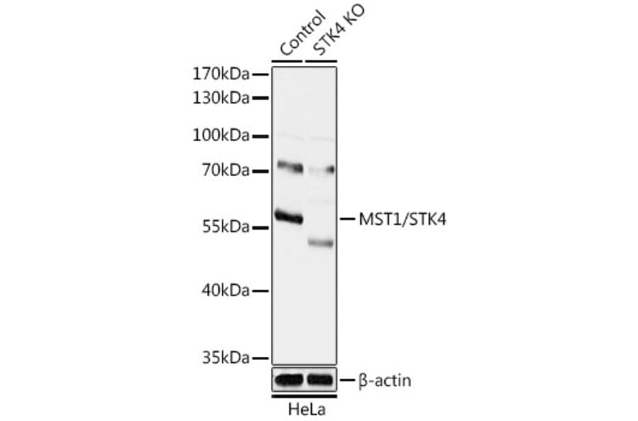 Western Blot - Anti-Serine/threonine-protein kinase 4/MST-1 Antibody (A92981) - Antibodies.com