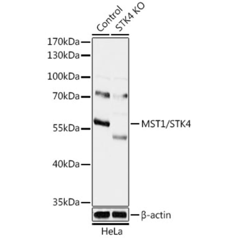 Western Blot - Anti-Serine/threonine-protein kinase 4/MST-1 Antibody (A92981) - Antibodies.com
