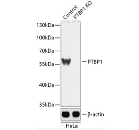 Western Blot - Anti-PTBP1 Antibody (A92982) - Antibodies.com