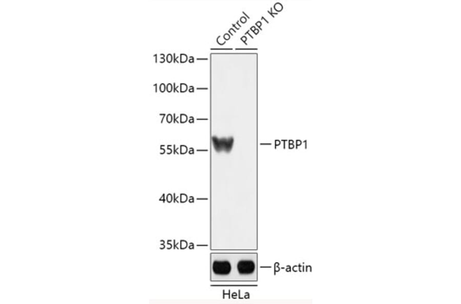 Western Blot - Anti-PTBP1 Antibody (A92982) - Antibodies.com