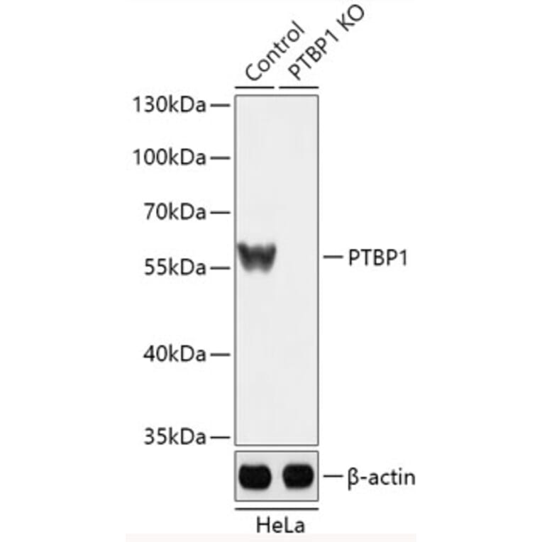 Western Blot - Anti-PTBP1 Antibody (A92982) - Antibodies.com