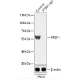 Western Blot - Anti-PTBP1 Antibody (A92982) - Antibodies.com