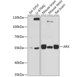 Western Blot - Anti-Arx Antibody (A92983) - Antibodies.com