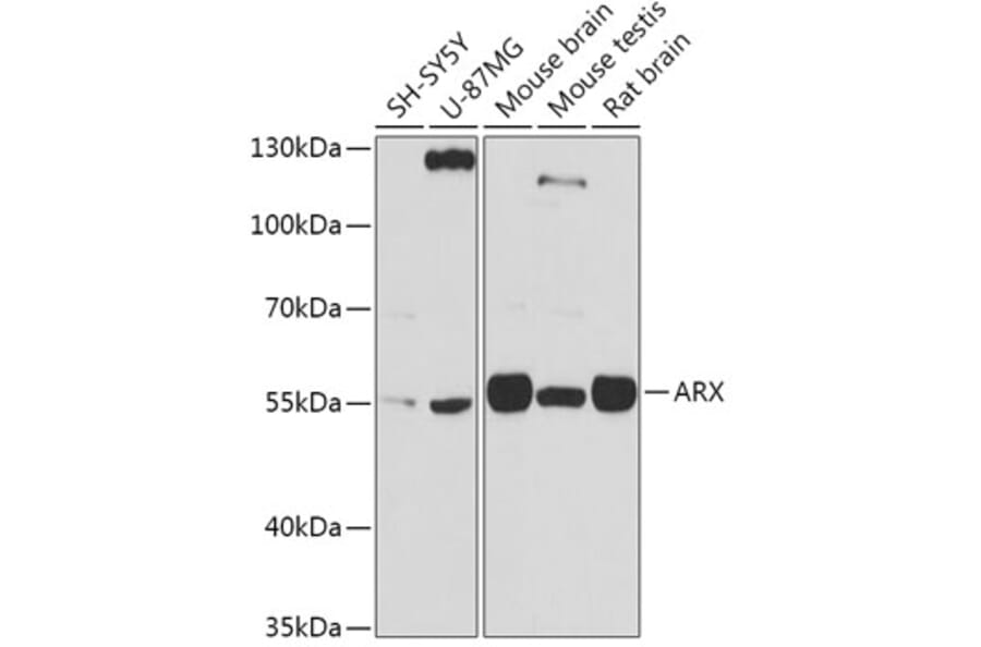 Western Blot - Anti-Arx Antibody (A92983) - Antibodies.com