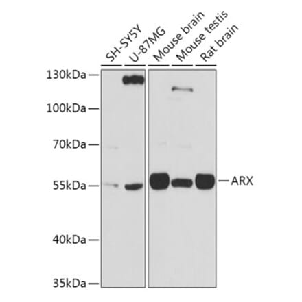 Western Blot - Anti-Arx Antibody (A92983) - Antibodies.com
