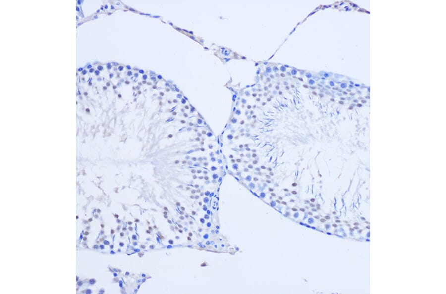 Immunohistochemistry - Anti-Arx Antibody (A92983) - Antibodies.com
