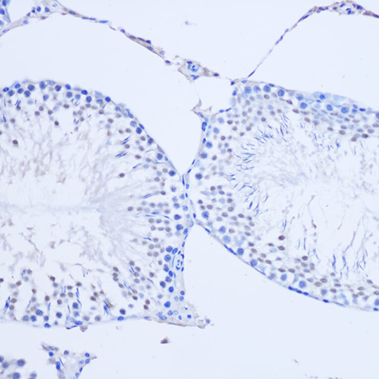 Immunohistochemistry - Anti-Arx Antibody (A92983) - Antibodies.com