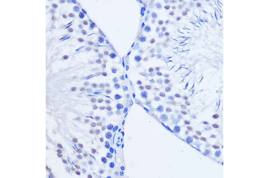 Immunohistochemistry - Anti-Arx Antibody (A92983) - Antibodies.com