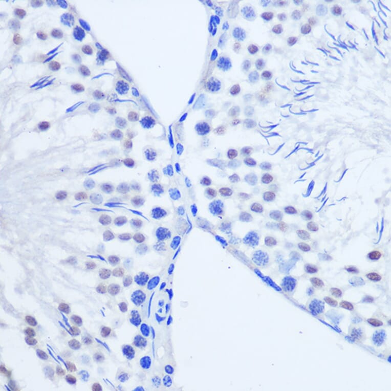 Immunohistochemistry - Anti-Arx Antibody (A92983) - Antibodies.com