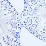 Immunohistochemistry - Anti-Arx Antibody (A92983) - Antibodies.com
