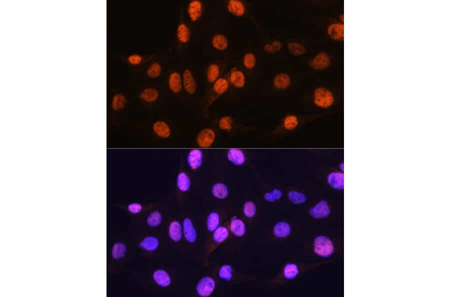 Immunofluorescence - Anti-Arx Antibody (A92983) - Antibodies.com