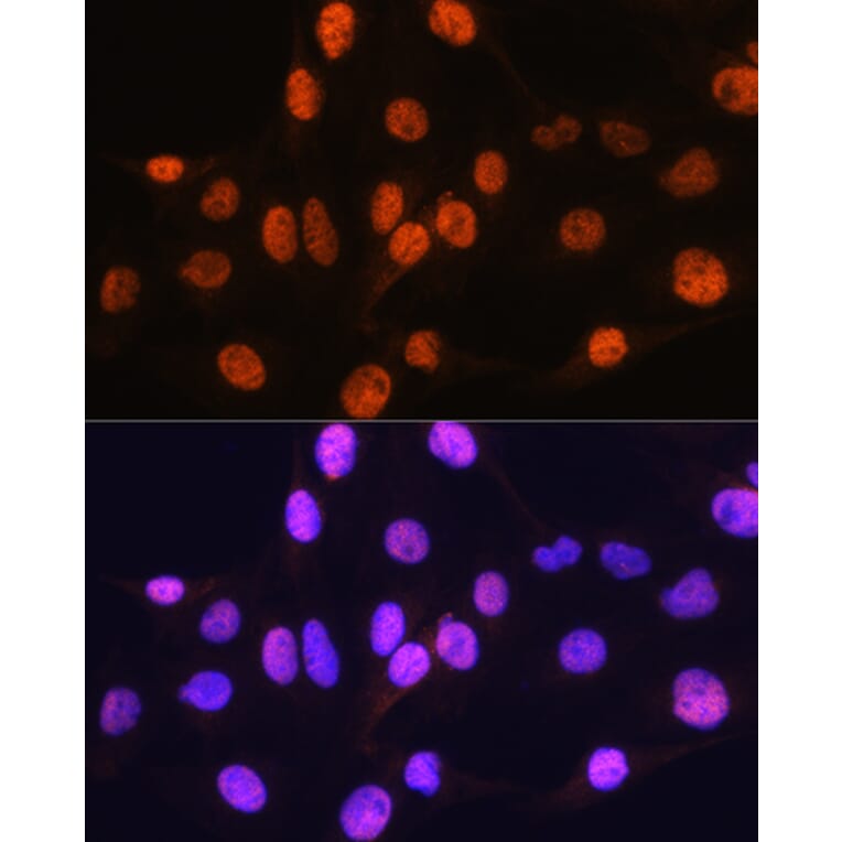 Immunofluorescence - Anti-Arx Antibody (A92983) - Antibodies.com