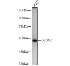 Western Blot - Anti-GSDMC Antibody (A92984) - Antibodies.com