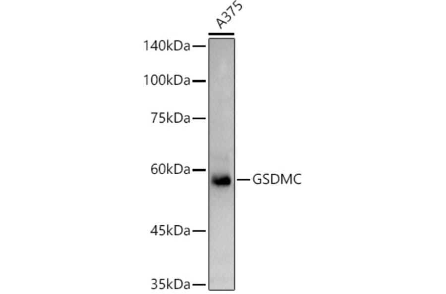 Western Blot - Anti-GSDMC Antibody (A92984) - Antibodies.com