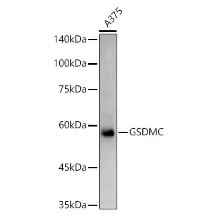 Western Blot - Anti-GSDMC Antibody (A92984) - Antibodies.com