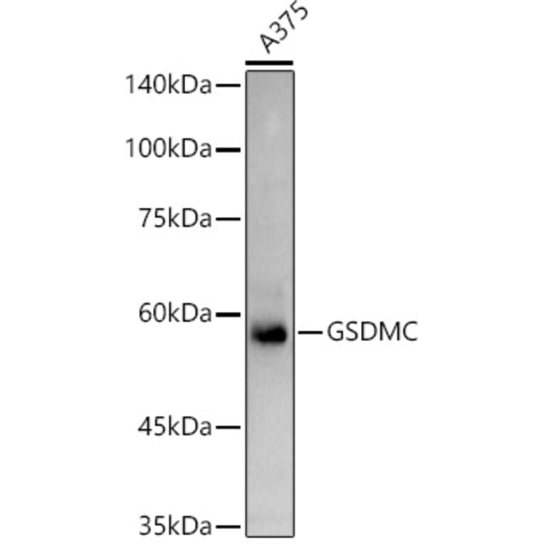 Western Blot - Anti-GSDMC Antibody (A92984) - Antibodies.com