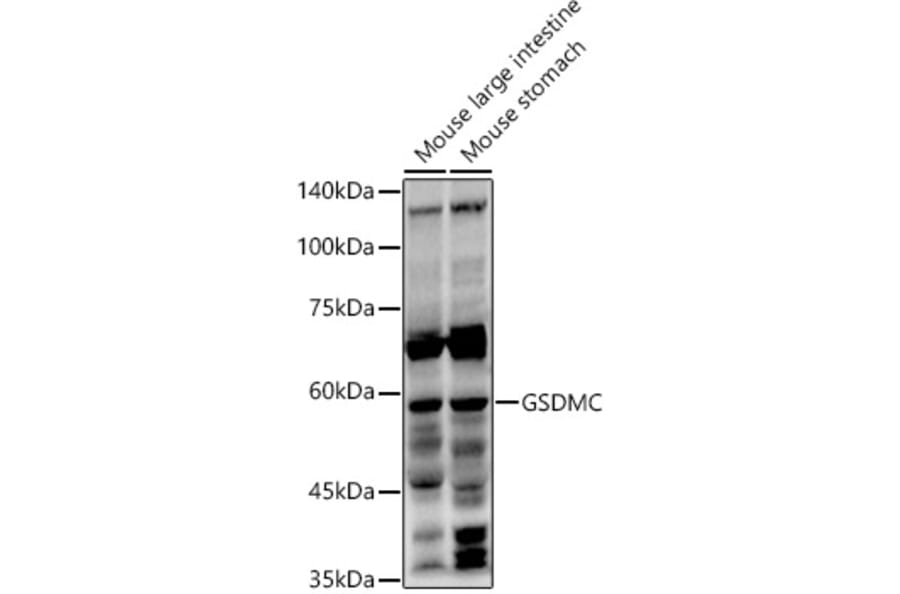 Western Blot - Anti-GSDMC Antibody (A92984) - Antibodies.com