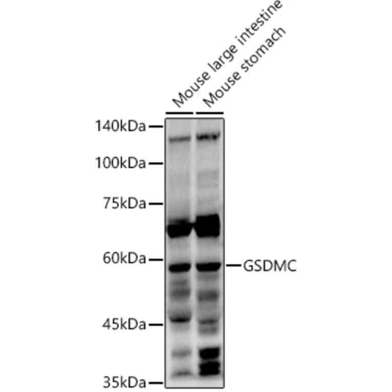 Western Blot - Anti-GSDMC Antibody (A92984) - Antibodies.com