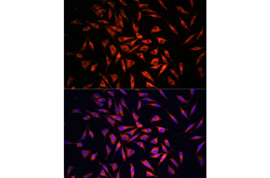 Immunofluorescence - Anti-GSDMC Antibody (A92984) - Antibodies.com