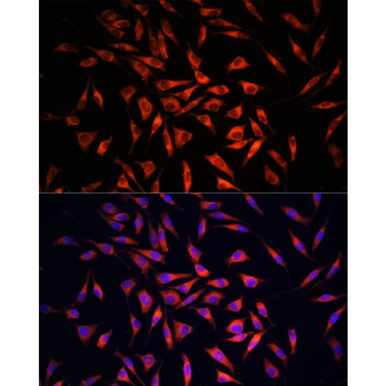 Immunofluorescence - Anti-GSDMC Antibody (A92984) - Antibodies.com