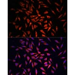 Immunofluorescence - Anti-GSDMC Antibody (A92984) - Antibodies.com