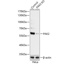 Western Blot - Anti-PAK2 Antibody (A92985) - Antibodies.com