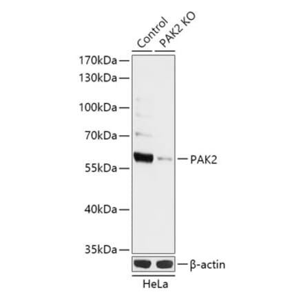 Western Blot - Anti-PAK2 Antibody (A92985) - Antibodies.com
