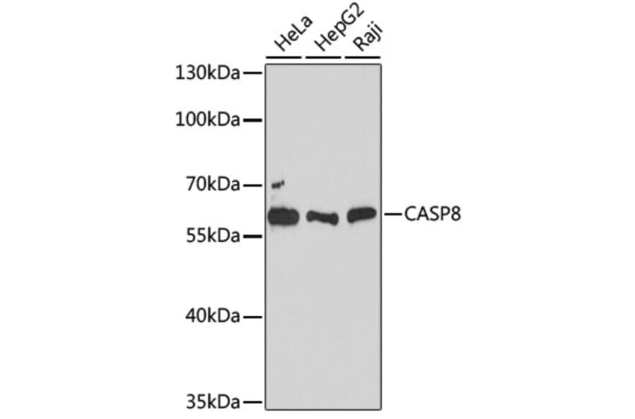 Western Blot - Anti-CASP8 Antibody (A12973) - Antibodies.com