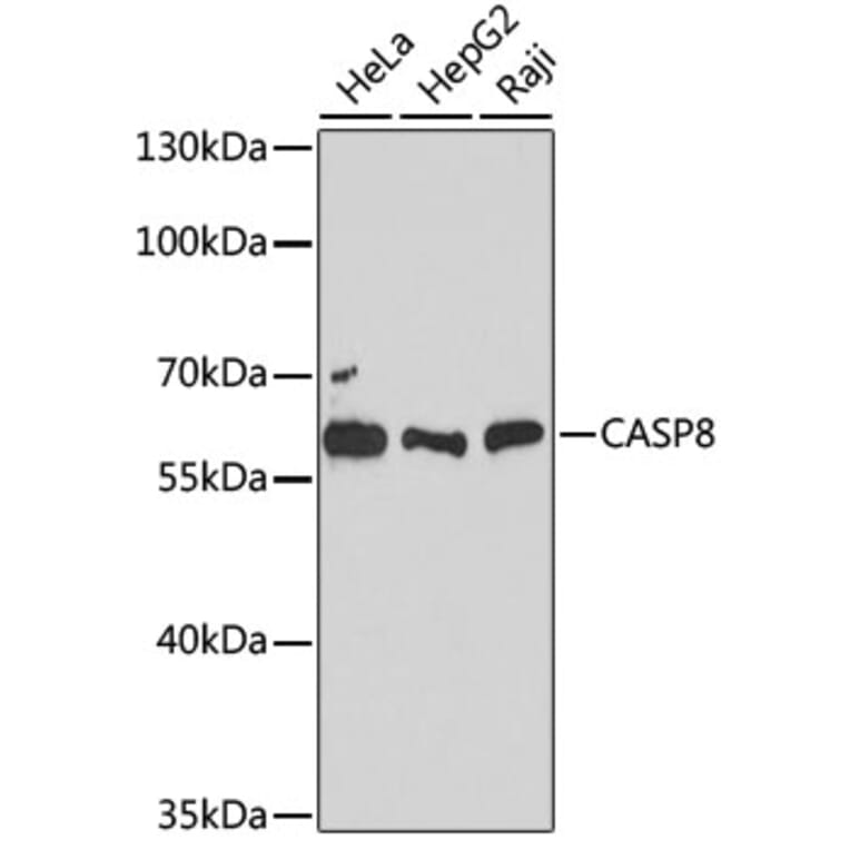Western Blot - Anti-CASP8 Antibody (A12973) - Antibodies.com