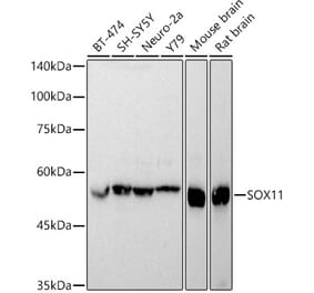 Western Blot - Anti-SOX11 Antibody (A92990) - Antibodies.com