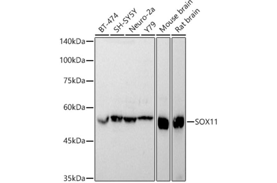 Western Blot - Anti-SOX11 Antibody (A92990) - Antibodies.com