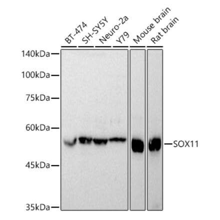 Western Blot - Anti-SOX11 Antibody (A92990) - Antibodies.com