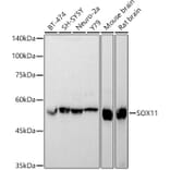 Western Blot - Anti-SOX11 Antibody (A92990) - Antibodies.com