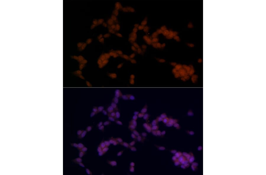 Immunofluorescence - Anti-SOX11 Antibody (A92990) - Antibodies.com
