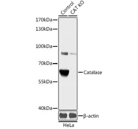 Western Blot - Anti-Catalase Antibody (A92991) - Antibodies.com